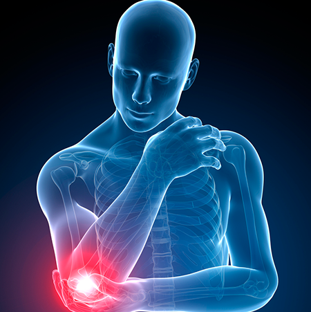 Epicondilite LateralAcessar