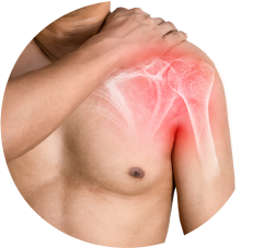 Fratura da ClavículaAcessar