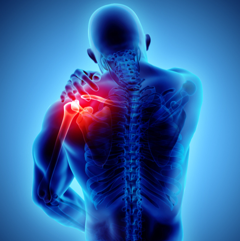 Tendinite e BursiteAcessar