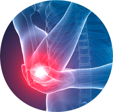 Epicondilite MedialAcessar