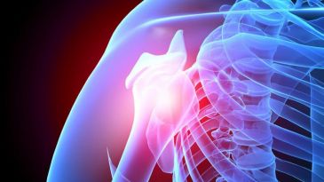 10 Coisas que Você Precisa Saber Sobre a Osteoporose